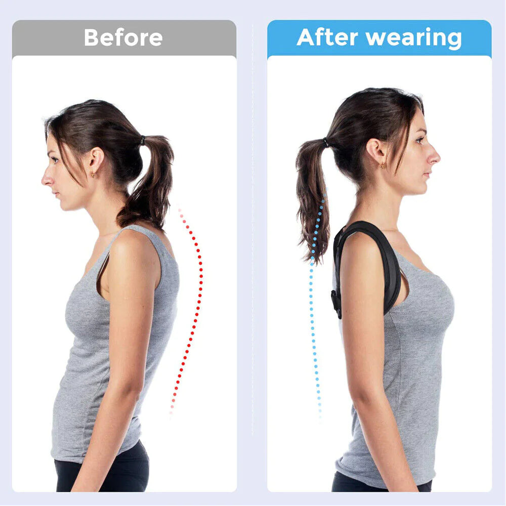 Adjustable Posture Corrector Back Brace